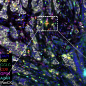 Novel Mechanism Supports Antitumor Response and T-cell Survival Image