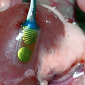 A close-up of a medical device on an internal organ